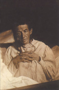 Auguste Deter, patiente d'Aloïs Alzheimer (1902)